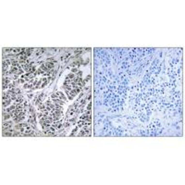 Immunohistochemistry - ATP5D Antibody from Signalway Antibody (34447) - Antibodies.com