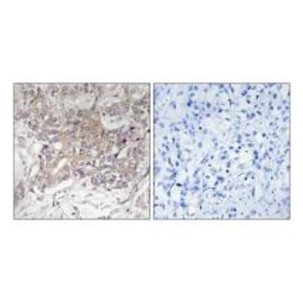 Immunohistochemistry - GCNT3 Antibody from Signalway Antibody (34483) - Antibodies.com