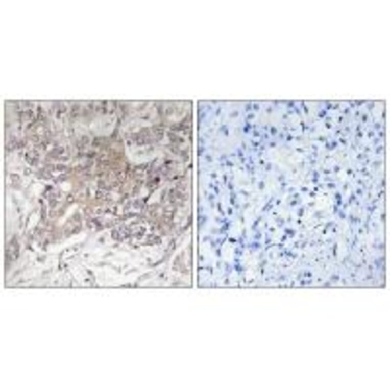 Immunohistochemistry - GCNT3 Antibody from Signalway Antibody (34483) - Antibodies.com