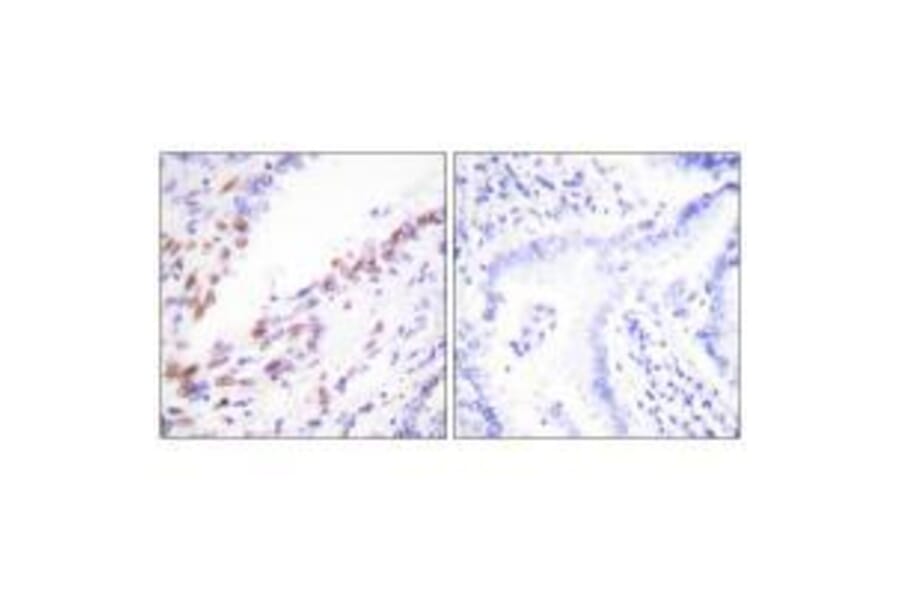 Immunohistochemistry - Ki67 Antibody from Signalway Antibody (33423) - Antibodies.com