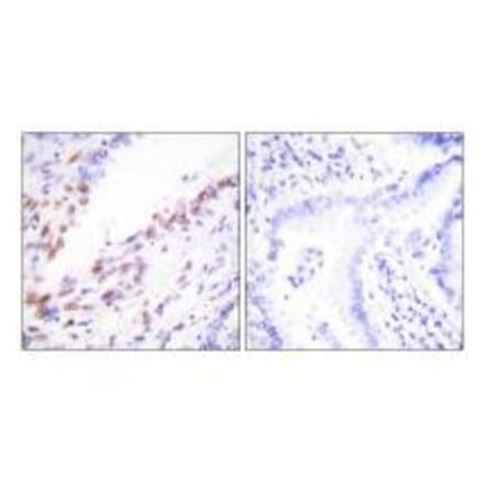 Immunohistochemistry - Ki67 Antibody from Signalway Antibody (33423) - Antibodies.com