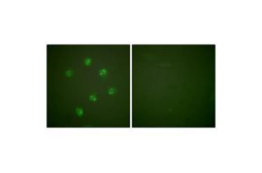 Immunofluorescence - Ki67 Antibody from Signalway Antibody (33423) - Antibodies.com