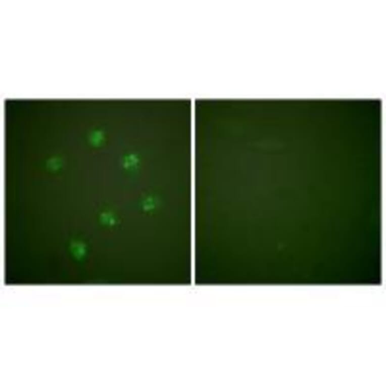 Immunofluorescence - Ki67 Antibody from Signalway Antibody (33423) - Antibodies.com