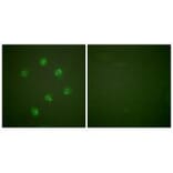 Immunofluorescence - Ki67 Antibody from Signalway Antibody (33423) - Antibodies.com