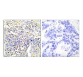 Immunohistochemistry - KAD1 Antibody from Signalway Antibody (33646) - Antibodies.com