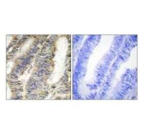 Immunohistochemistry - TNFA Antibody from Signalway Antibody (33648) - Antibodies.com