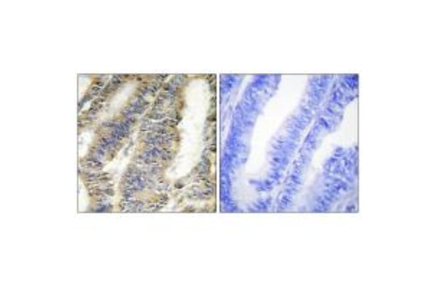 Immunohistochemistry - TNFA Antibody from Signalway Antibody (33648) - Antibodies.com