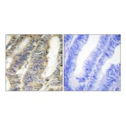 Immunohistochemistry - TNFA Antibody from Signalway Antibody (33648) - Antibodies.com
