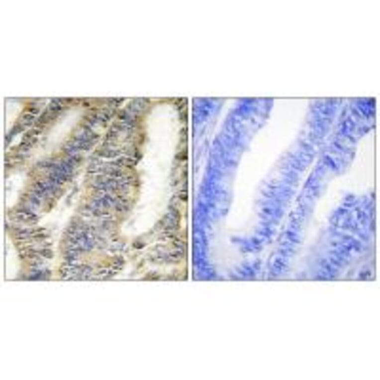 Immunohistochemistry - TNFA Antibody from Signalway Antibody (33648) - Antibodies.com