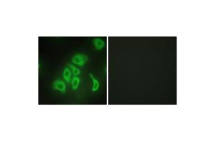 Immunofluorescence - TNFA Antibody from Signalway Antibody (33648) - Antibodies.com