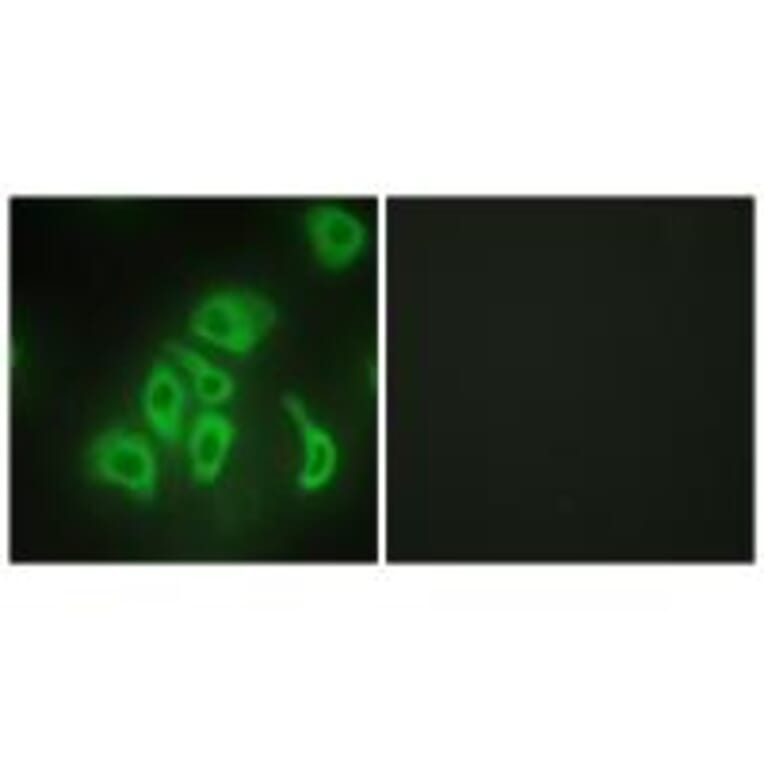 Immunofluorescence - TNFA Antibody from Signalway Antibody (33648) - Antibodies.com