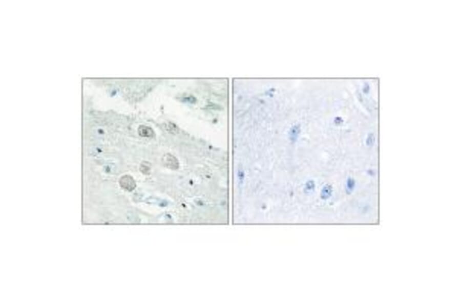 Immunohistochemistry - JAK1 Antibody from Signalway Antibody (33721) - Antibodies.com