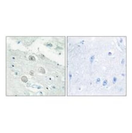 Immunohistochemistry - JAK1 Antibody from Signalway Antibody (33721) - Antibodies.com