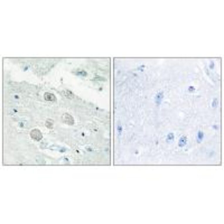 Immunohistochemistry - JAK1 Antibody from Signalway Antibody (33721) - Antibodies.com