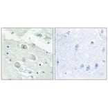 Immunohistochemistry - JAK1 Antibody from Signalway Antibody (33721) - Antibodies.com