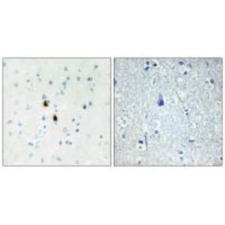 Immunohistochemistry - IPKA Antibody from Signalway Antibody (33832) - Antibodies.com