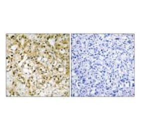 Immunohistochemistry - TFAM Antibody from Signalway Antibody (33841) - Antibodies.com