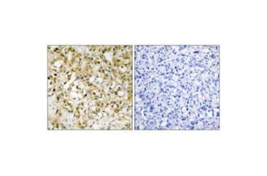 Immunohistochemistry - TFAM Antibody from Signalway Antibody (33841) - Antibodies.com