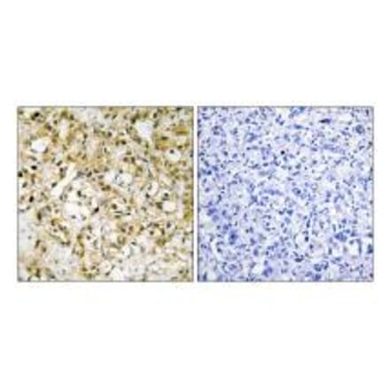 Immunohistochemistry - TFAM Antibody from Signalway Antibody (33841) - Antibodies.com