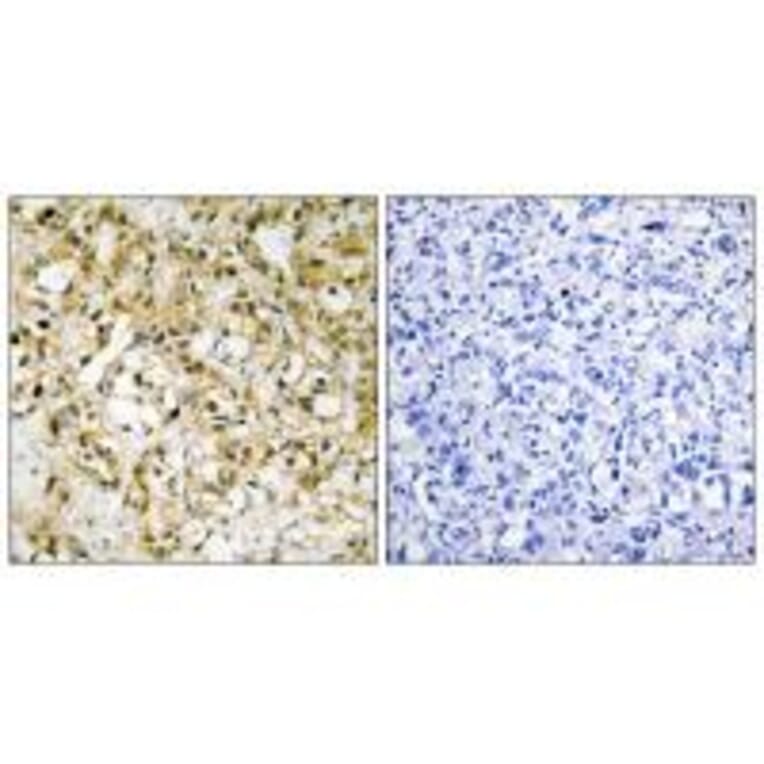 Immunohistochemistry - TFAM Antibody from Signalway Antibody (33841) - Antibodies.com
