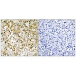Immunohistochemistry - TFAM Antibody from Signalway Antibody (33841) - Antibodies.com