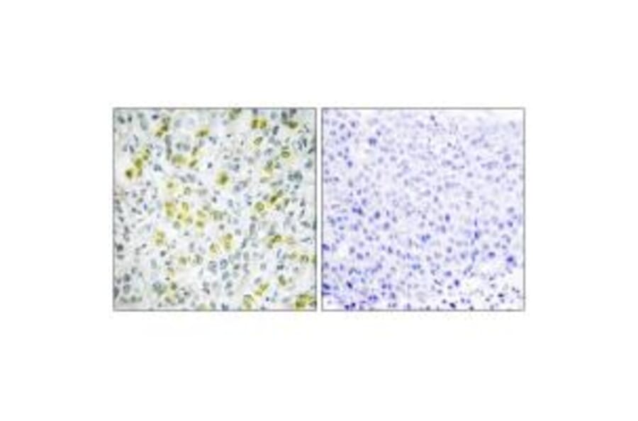 Immunohistochemistry - CHD4 Antibody from Signalway Antibody (33885) - Antibodies.com
