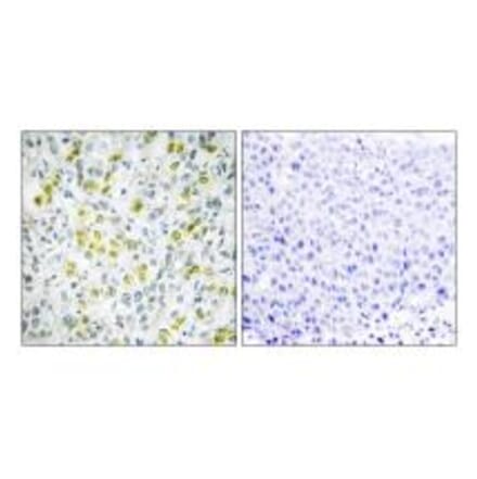 Immunohistochemistry - CHD4 Antibody from Signalway Antibody (33885) - Antibodies.com