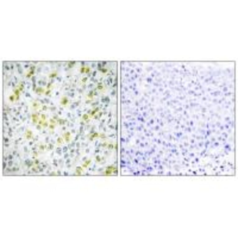 Immunohistochemistry - CHD4 Antibody from Signalway Antibody (33885) - Antibodies.com