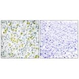 Immunohistochemistry - CHD4 Antibody from Signalway Antibody (33885) - Antibodies.com
