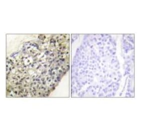 Immunohistochemistry - LATH Antibody from Signalway Antibody (33955) - Antibodies.com