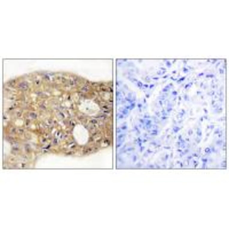 Immunohistochemistry - AGR3 Antibody from Signalway Antibody (33987) - Antibodies.com