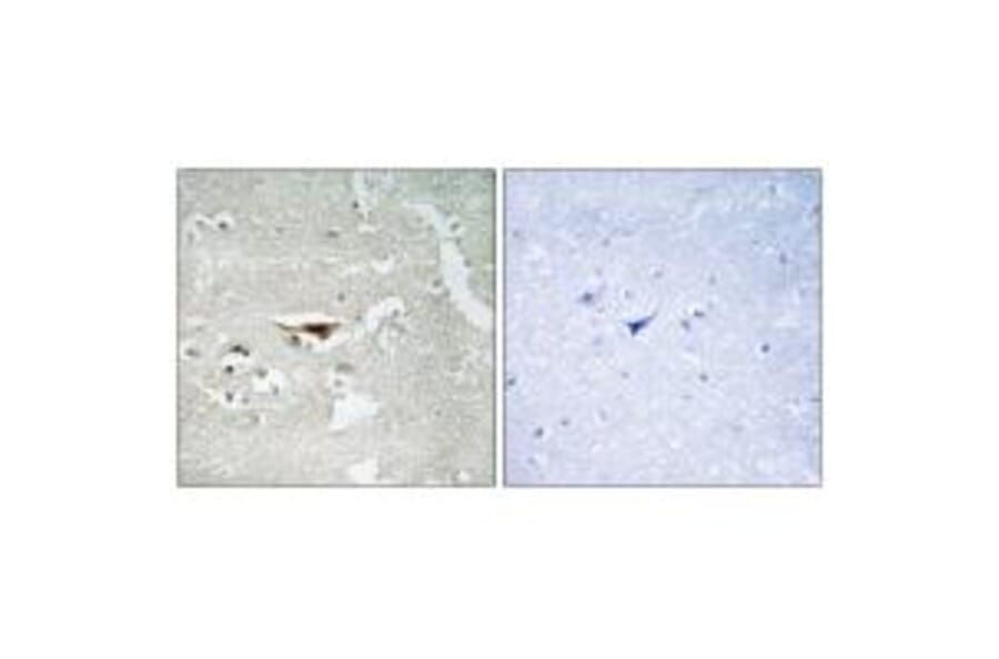 Immunohistochemistry - IPKB Antibody from Signalway Antibody (34054) - Antibodies.com