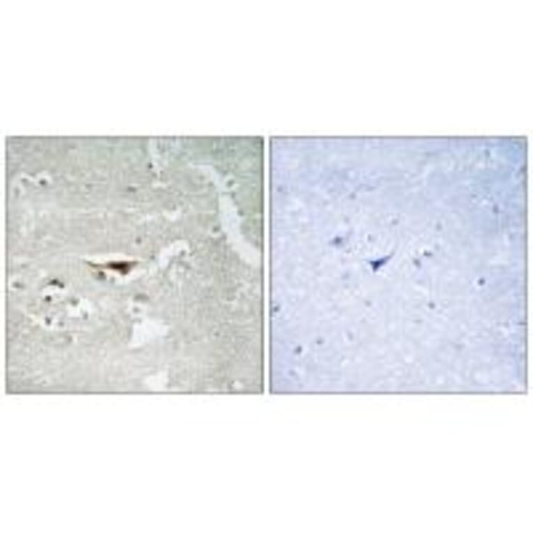 Immunohistochemistry - IPKB Antibody from Signalway Antibody (34054) - Antibodies.com