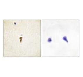 Immunohistochemistry - ICK Antibody from Signalway Antibody (34122) - Antibodies.com