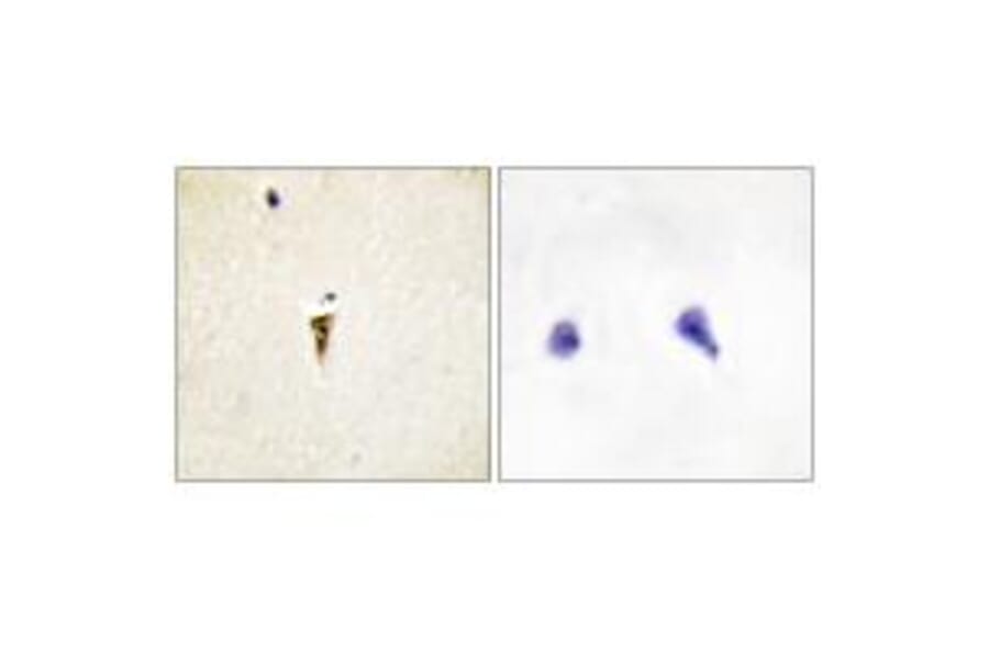 Immunohistochemistry - ICK Antibody from Signalway Antibody (34122) - Antibodies.com