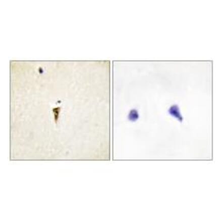 Immunohistochemistry - ICK Antibody from Signalway Antibody (34122) - Antibodies.com