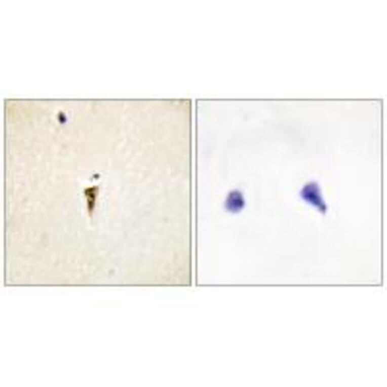 Immunohistochemistry - ICK Antibody from Signalway Antibody (34122) - Antibodies.com