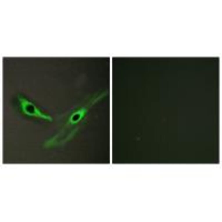 Immunofluorescence - ICK Antibody from Signalway Antibody (34122) - Antibodies.com