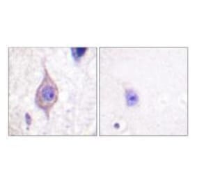 Immunohistochemistry - ALK Antibody from Signalway Antibody (33146) - Antibodies.com
