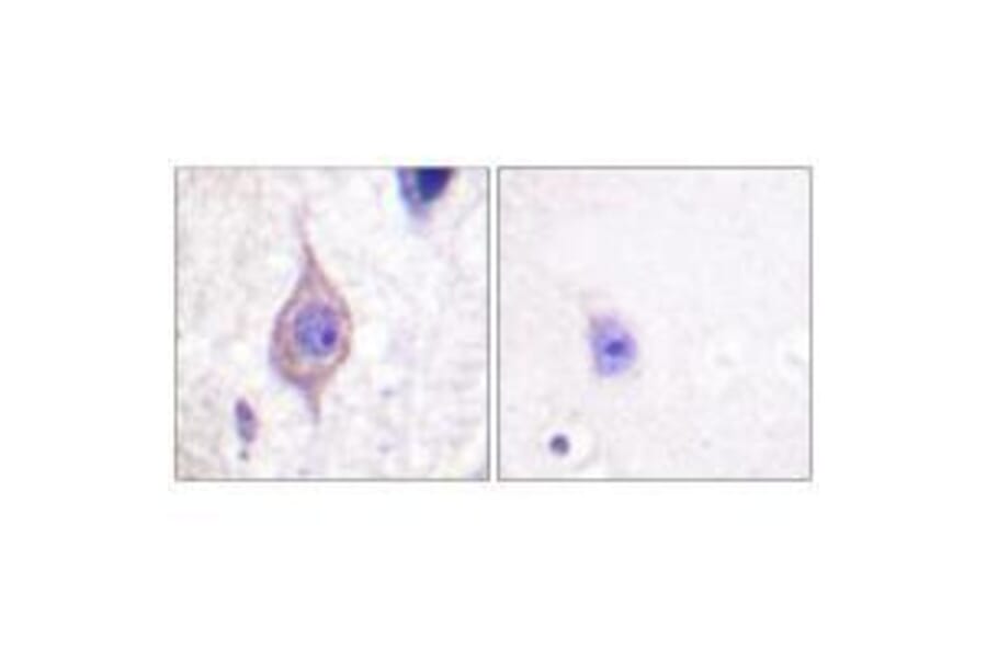 Immunohistochemistry - ALK Antibody from Signalway Antibody (33146) - Antibodies.com