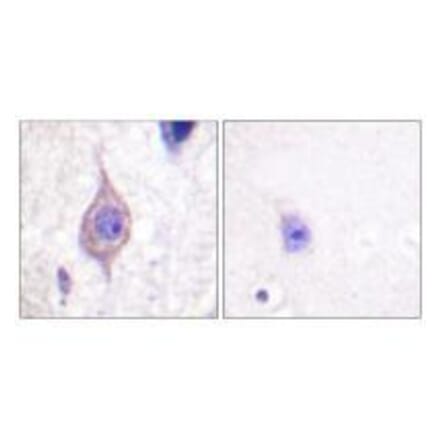 Immunohistochemistry - ALK Antibody from Signalway Antibody (33146) - Antibodies.com