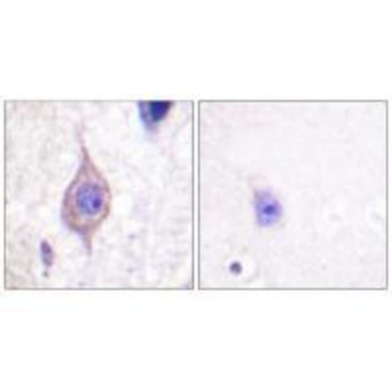 Immunohistochemistry - ALK Antibody from Signalway Antibody (33146) - Antibodies.com