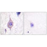 Immunohistochemistry - ALK Antibody from Signalway Antibody (33146) - Antibodies.com