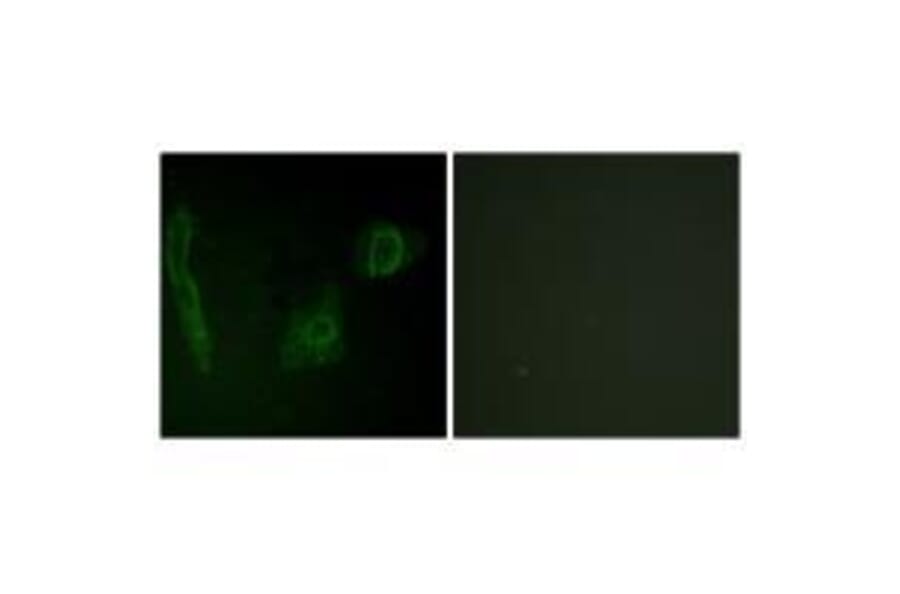 Immunofluorescence - ALK Antibody from Signalway Antibody (33146) - Antibodies.com