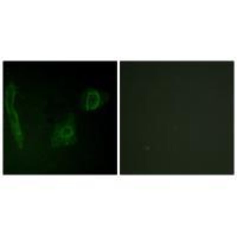 Immunofluorescence - ALK Antibody from Signalway Antibody (33146) - Antibodies.com