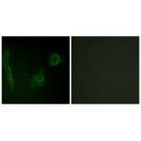 Immunofluorescence - ALK Antibody from Signalway Antibody (33146) - Antibodies.com