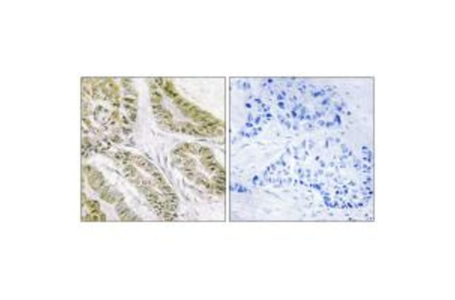 Immunohistochemistry - BAX Antibody from Signalway Antibody (34261) - Antibodies.com