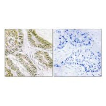 Immunohistochemistry - BAX Antibody from Signalway Antibody (34261) - Antibodies.com