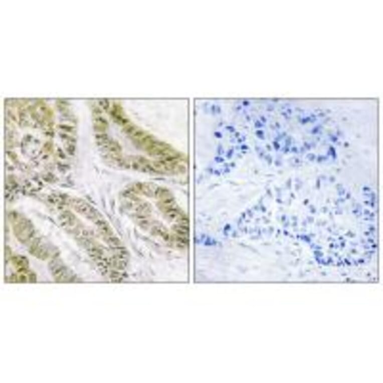 Immunohistochemistry - BAX Antibody from Signalway Antibody (34261) - Antibodies.com