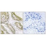 Immunohistochemistry - BAX Antibody from Signalway Antibody (34261) - Antibodies.com